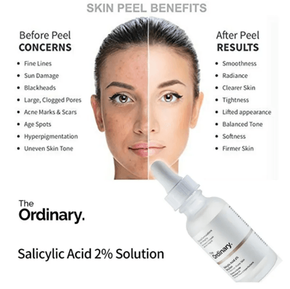 The Ordinary Salicylic Acid 2% Solution - 30ml - Image 2